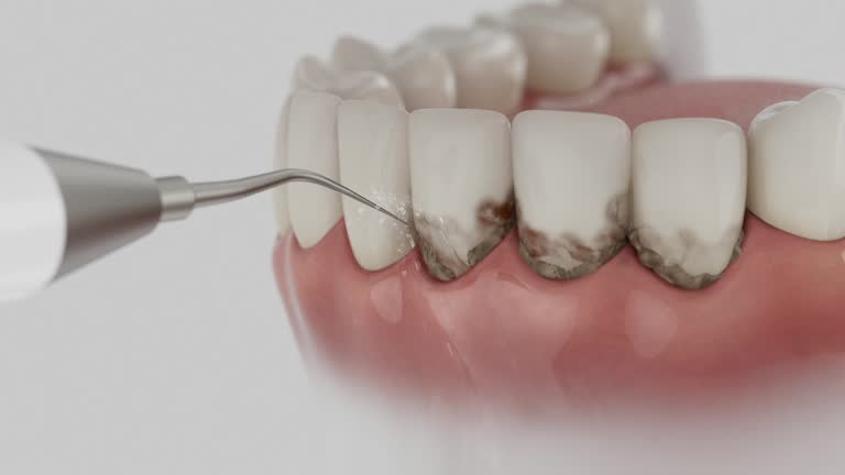 Reliable Dental contractor in Hebron, NE by Smile Center Dentistry